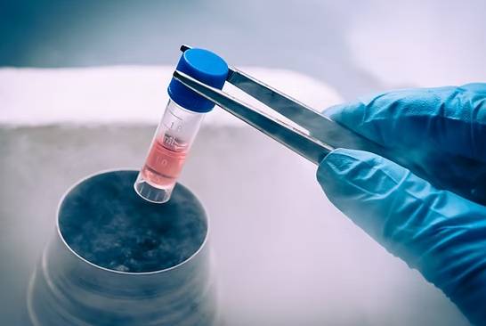 Placenta extract